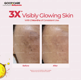 Goodcare Kumkumadi Oil 30Ml